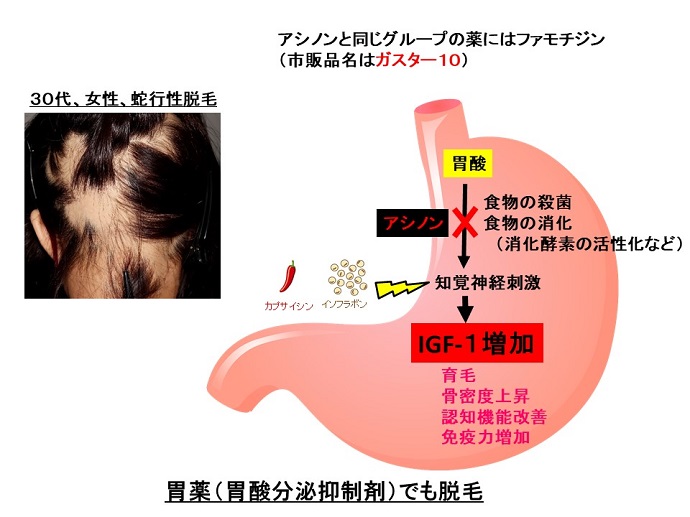 円形脱毛症　病院